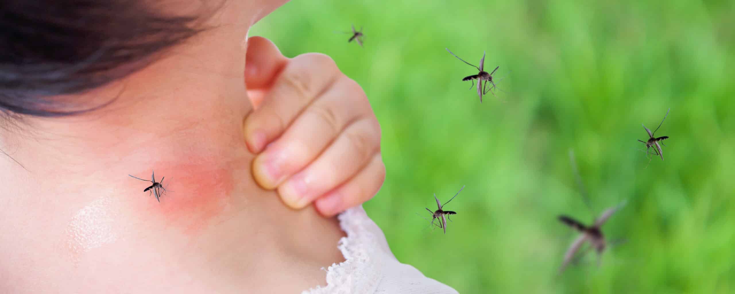 mosquito, mossie, bite, mossie magnet, bug spray, repellent, why, midgie, natural, alternative, chemical, tincture, study trial, science, answer